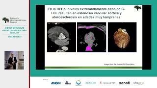 Hipercolesterolemia Familiar Homocigota Actualización en el diagnóstico y tratamiento [upl. by Remled]