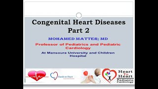 congenital acyanotic heart disease part 2 [upl. by Alegnaoj]