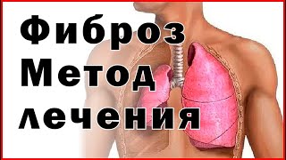 Фиброз Метод лечения  Fibrosis Treatment method [upl. by Arratahs365]