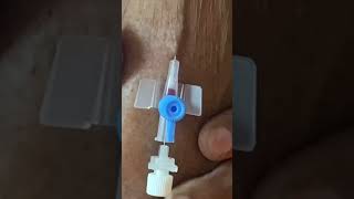 IV cannula insertiondoctertrendingforyoushortvideoviralvideo [upl. by Ahsian477]