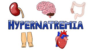 An Approach to Hypernatremia  Hypernatremia Diagnostic Algorithm  Hypernatremia Causes MADE EASY [upl. by Adna381]