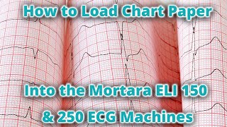 How to Load Chart Paper in the Mortara ELI 150 amp 250 ECG Machines [upl. by Oludoet481]