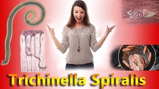 Trichinell Spiralis Complete Overview [upl. by Garges]