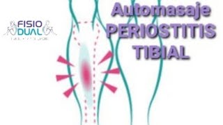 Automasaje PERIOSTITIS TIBIAL [upl. by Nednyl832]