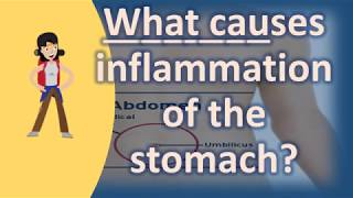 What causes inflammation of the stomach   Health FAQs [upl. by Gluck]