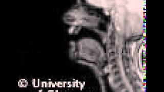 MRI voiceless alveolar lateralfricative [upl. by Zink]