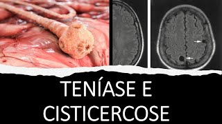 Teníase e Cisticercose [upl. by Nodmac689]