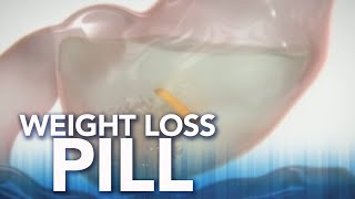 FDA approves new weight loss pill [upl. by Deloria619]