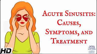 Acute sinusitis  Everything you need to know [upl. by Siravat901]