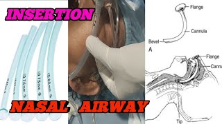 HOW TO INSERT THE NASOPHARYNGEAL AIRWAY INSERTION NASAL AIRWAY NPABENGALI LANGUAGE [upl. by Nyrol695]