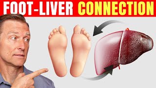 How to Use Your Feet to Diagnose Liver Problems—Dr Berg Explains [upl. by Delia]