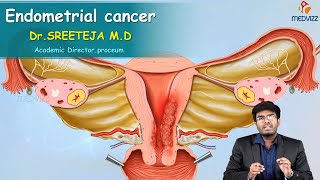 Endometrial Cancer  Obstetrics and gynaecology Video lectures Version 20  Medvizz app [upl. by Bram491]