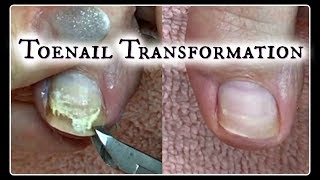 Pedicure Tutorial Toenail Transformation and Time Saving Tips ✔ [upl. by Reuven]