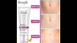 RtopR mango slimming Cream ReviewStretch Marks Remover Cream [upl. by Skippie]