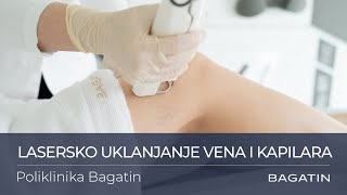 Lasersko uklanjanje vena i kapilara u Poliklinici Bagatin [upl. by Anitrak]