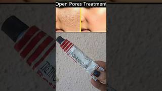 Open pores removal best cream retino a cream remove open pores skincare shortsvideo [upl. by Neurath]