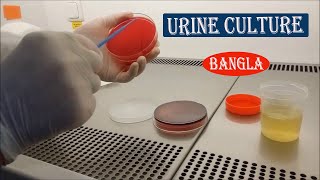 Urine Culture Test Bangla [upl. by Ierna]