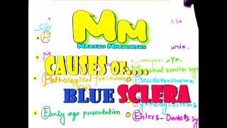 Mnemonic For Causes of Blue Sclera An Interesting Mnemonic For NeetPG USMLE step 1 Prep [upl. by Llehcnom]