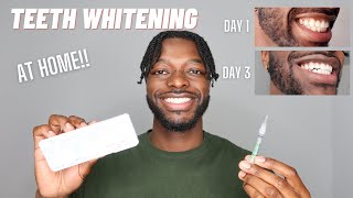 MY TEETH WHITENING ROUTINE AT HOME  OPALESCENCE TEETH WHITENING [upl. by Della]