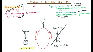 Rinne amp Weber Testing [upl. by Ahsuoj639]