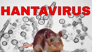 🔴HANTAVIRUS🔴 Hantavirus Síntomas diagnóstico y tratamiento de Hantavirus SUSCRIBETE 🙏👍🔔 [upl. by Jann498]