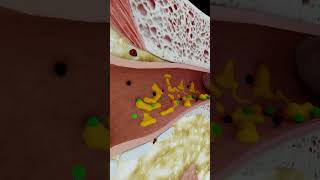 Why Earwax Matters short earwax  creativelearning3d [upl. by Ayatnwahs]