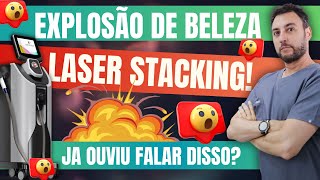 LASER STACKING  Explosão de Beleza Vc já ouviu falar disso [upl. by Aldos]