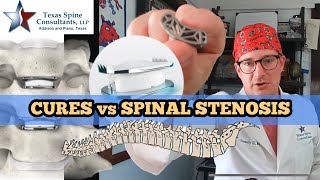 Can spine stenosis be cured [upl. by Aiak]