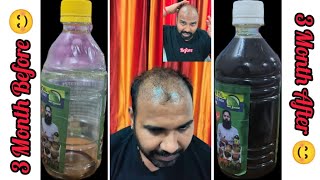 How To Use Adivasi Hair OilHow To Apply Adivasi Oil3 Month After Review part3 adivasi oil vlog [upl. by Iaoh849]