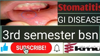 stomatitisGastrointestinal disease 1 stomatitisKMU BSN 3rd semester AHN types of stomatitis [upl. by Ibbed678]