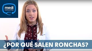 Ronchas ¿por qué aparecen MediConsultas [upl. by Ynffit]