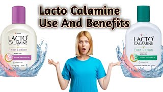 Lacto Calamine Face Lotion Use And Benefits trending trendingvideo viralvideo video viralvideos [upl. by Esinned]