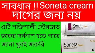 Mukher kalo dag dur korar upay  soneta cream এর কাজ কি অপকারিতা প্বার্শ প্রতিক্রিয়া সতর্কতা। [upl. by Ljoka]