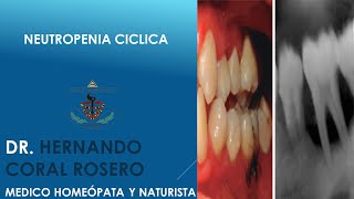 NEUTROPENIA CICLICA [upl. by Gigi]