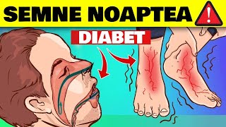 7 SEMNE ALARMANTE ALE DIABETULUI NOAPTEA [upl. by Eckblad]