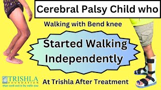 Dystonic Diplegic Cerebral Palsy with Crouch Gait got Excellent Walking Capability after treatment [upl. by Arted]