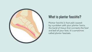 Plantar Fasciitis Causes Symptoms and Treatment  Merck Manual Consumer Version [upl. by Hamnet]