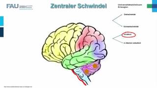 HNO ─ Schwindel Teil 22 [upl. by Roda766]