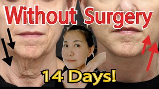 Remove Buccal Fat Reduce Cheek Fat Get Tight Skin Around Your Neck With This Massage🔥No Surgery💖 [upl. by Hooke877]