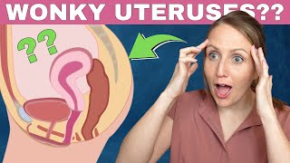 What is a retroverted uterus [upl. by Denby]