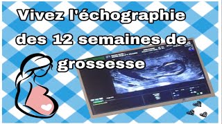 Comment se passe la Première Echographie détaillée des 12 semaines Ma Grossesse [upl. by Carmelia]