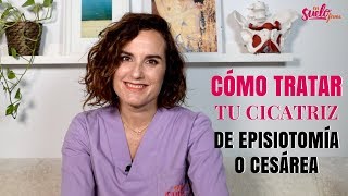 ❤️🤱🏻Masaje de la CICATRIZ de CESÁREA o EPISIOTOMÍA [upl. by Nomihs]