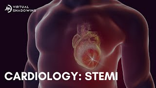 Virtual Shadowing Cardiology  STEMIs [upl. by Attolrac]