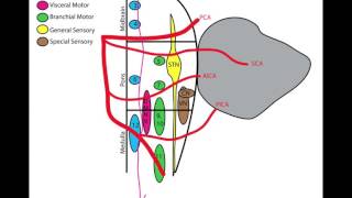 Lateral Medullary Wallenberg Syndrome [upl. by Dorran]