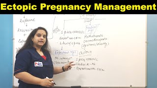 Management of Ectopic Pregnancy  Nursing Lecture [upl. by Zsuedat]