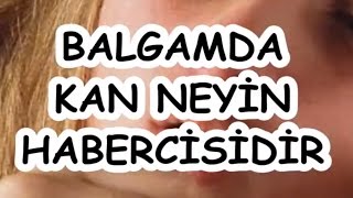 BALGAMDA KAN NEYİN HABERCİSİDİR [upl. by Raynor203]