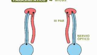 Reflejos pupilares  Oftalmología [upl. by Zebadiah]