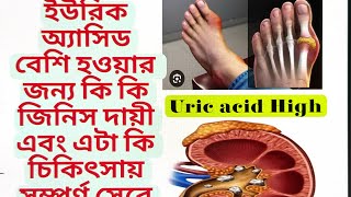 Discussion of Hyperuricemiaইউরিক অ্যাসিড বেশিcausesSymptomsDiagnosisHomeopathy Treatment [upl. by Lem]