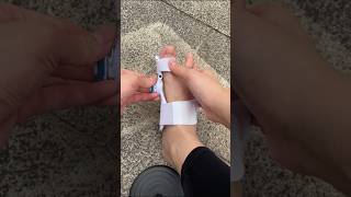 Part 244 FootCare ThumbValgus BigFootBoneProtrusionviralvideoytshorts [upl. by Damales]