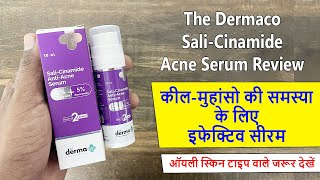 Serum for Acne Pimples  The Dermaco Sali Cinamide AntiAcne Serum Review [upl. by Forsyth]